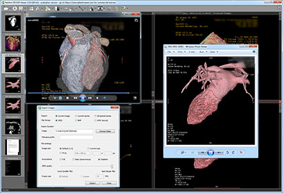 Export DICOM files to images and movies