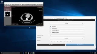radiant dicom viewer mac free download