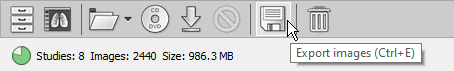 RadiAnt-DICOM-Viewer-Local-Archive-Export-Button