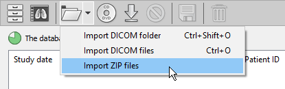 RadiAnt-DICOM-Viewer-Local-Archive-Import-ZIP-Menu