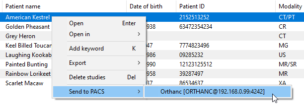 RadiAnt-DICOM-Viewer-Local-Archive-Send-To-PACS