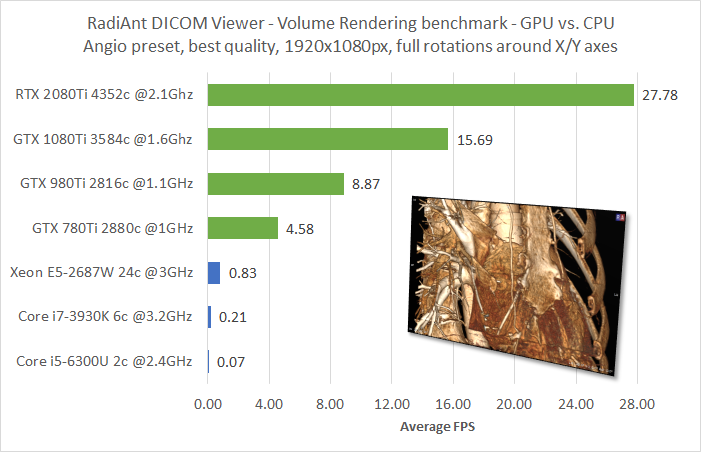 RadiAnt-DICOM-Viewer-Volume-Rendering-Benchmark