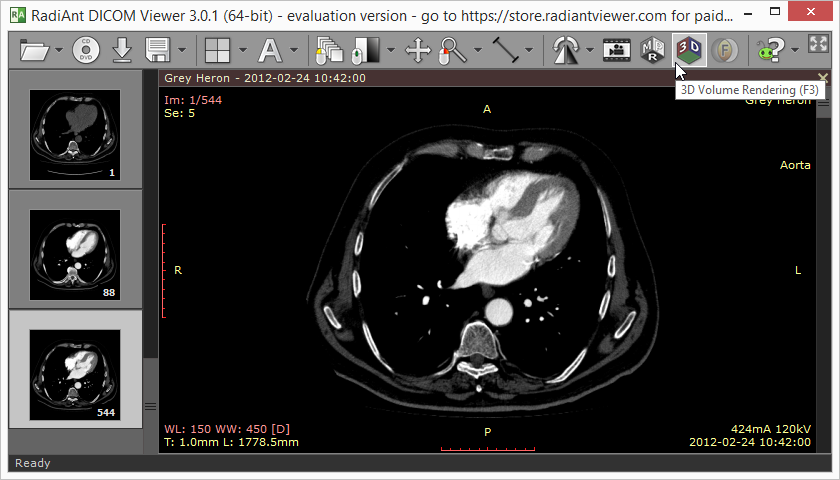 RadiAnt_DICOM_Viewer_3D_Volume_Rendering_Source_Series