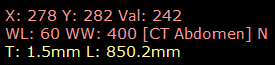 RadiAnt_DICOM_Viewer_Annotations_BottomLeft