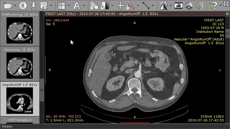 RadiAnt_DICOM_Viewer_Browsing_Series