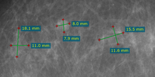 The distance is calculated using the estimated radiographic magnification factor.