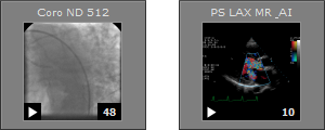 RadiAnt_DICOM_Viewer_Cine_Series_Thumbnail
