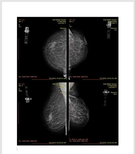 RadiAnt_DICOM_Viewer_Export_CopyAllToClipboard_PasteToWord