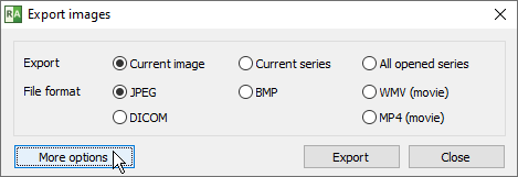 RadiAnt_DICOM_Viewer_Export_More_Options