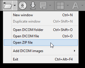 RadiAnt_DICOM_Viewer_Folder_Menu