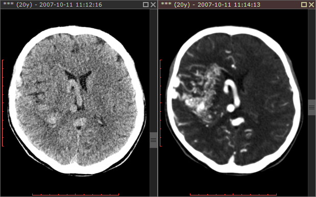 RadiAnt_DICOM_Viewer_Synchronization_Screen