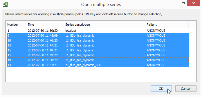 RadiAnt_DICOM_Viewer_Time_Intensity_Curves_Series_Selection