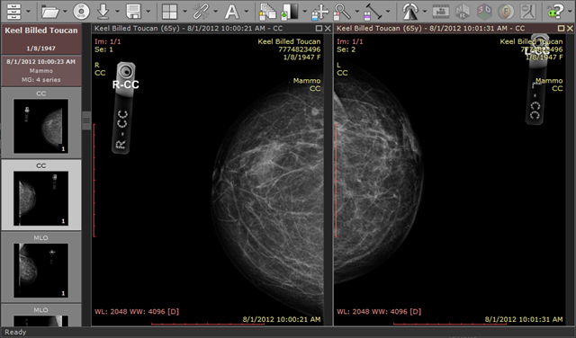 Radiant-Dicom-Viewer-Distraction-Free-Mode-Off