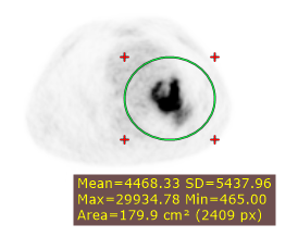 Radiant-Dicom-Viewer-Ellipse-SUV-Basic-Units