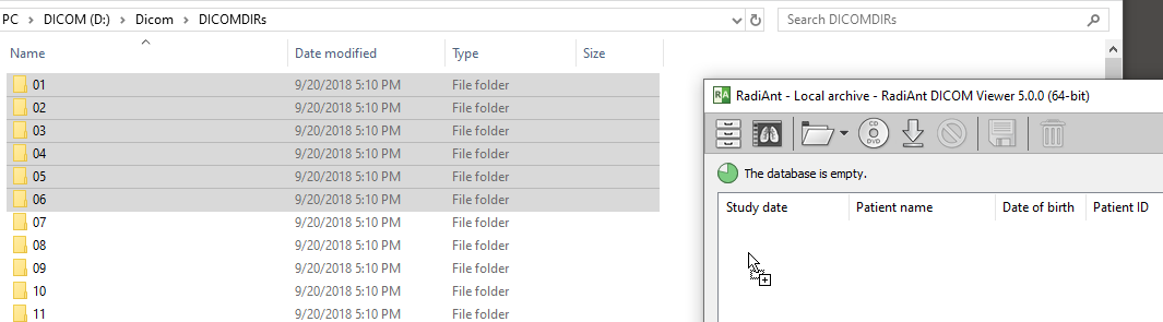 RadiAnt-DICOM-Viewer-Local-Archive-Drag-And-Drop-Folder