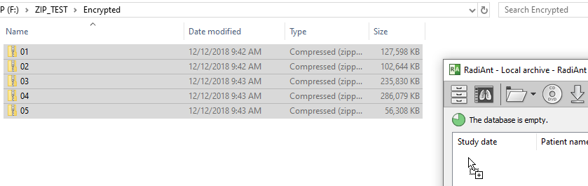 RadiAnt-DICOM-Viewer-Local-Archive-Drag-And-Drop-ZIP