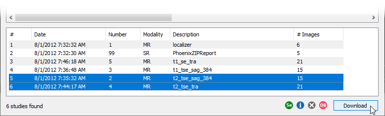 Radiant-Dicom-Viewer-PACS-Download-Specific-Series