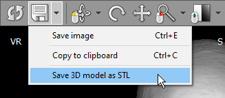 RadiAnt-DICOM-Viewer-STL-Export-Menu