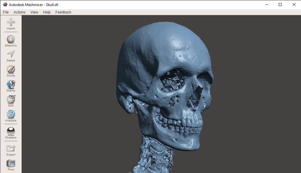 RadiAnt-DICOM-Viewer-STL-Export-Meshmixer