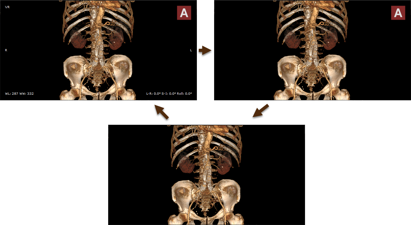 RadiAnt-DICOM-Viewer-VR-Annotations-Modes