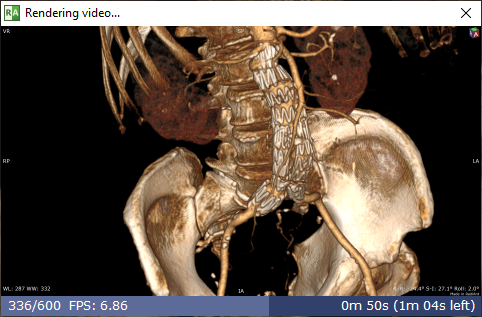 RadiAnt-DICOM-Viewer-VR-Quick-Movie-Export-Preview