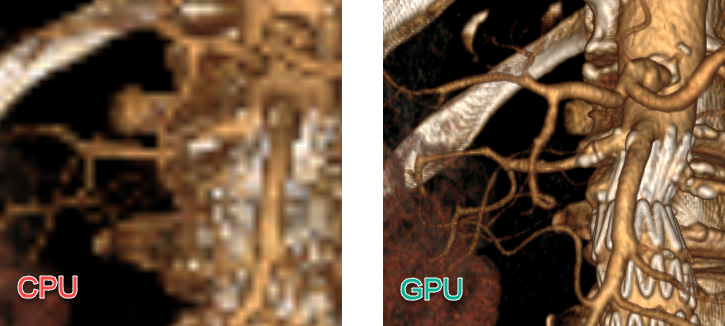 RadiAnt_DICOM_Viewer_3D_Volume_Rendering_GPUvsCPU