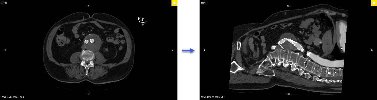 RadiAnt_DICOM_Viewer_3DMPR_3DRotation