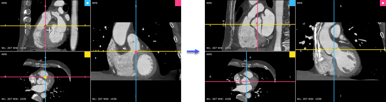 RadiAnt_DICOM_Viewer_3DMPR_Axes_Move