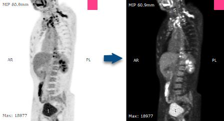 RadiAnt_DICOM_Viewer_3DMPR_NegativeSample