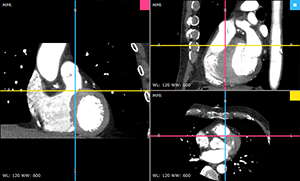 RadiAnt_DICOM_Viewer_3DMPR_ViewportLayoutCols12