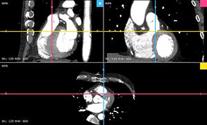 RadiAnt_DICOM_Viewer_3DMPR_ViewportLayoutRows21