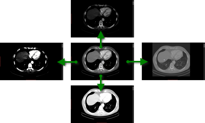 RadiAnt_DICOM_Viewer_Adjust_Window_Mouse_Moves