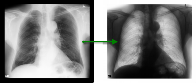 RadiAnt_DICOM_Viewer_Adjust_Window_Negative_Mode