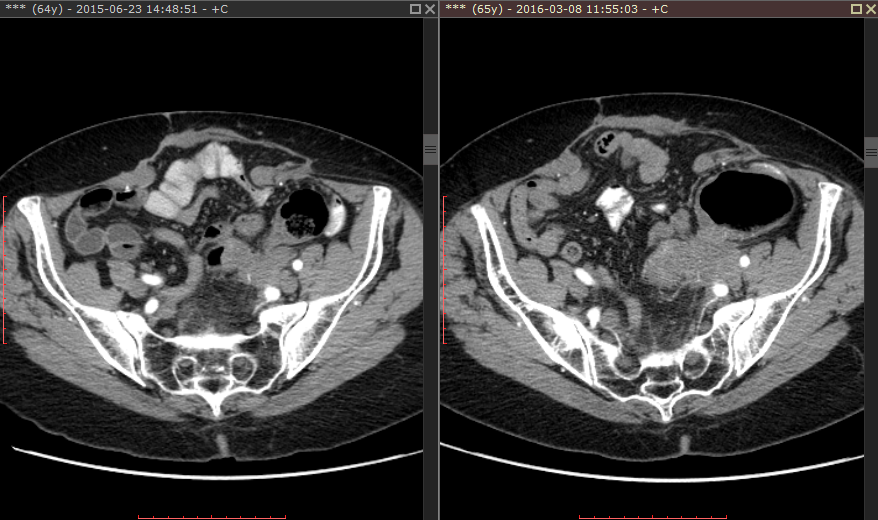 RadiAnt_DICOM_Viewer_Synchronization_Screen_Manual