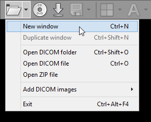 RadiAnt_DICOM_Viewer_Window_NewWindow